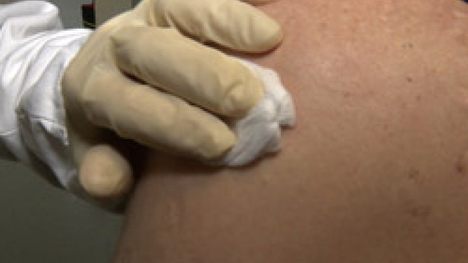 vaccinazionePiù vaccini sul Titano: lanciata la campagna di vaccinazione antinfluenzale