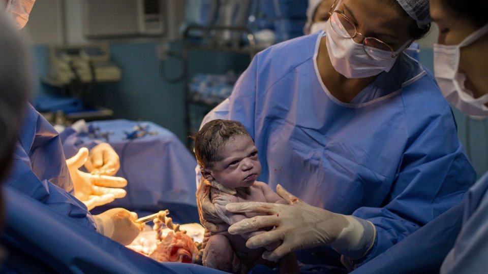 L'espressione arrabbiata della neonata davanti al medico