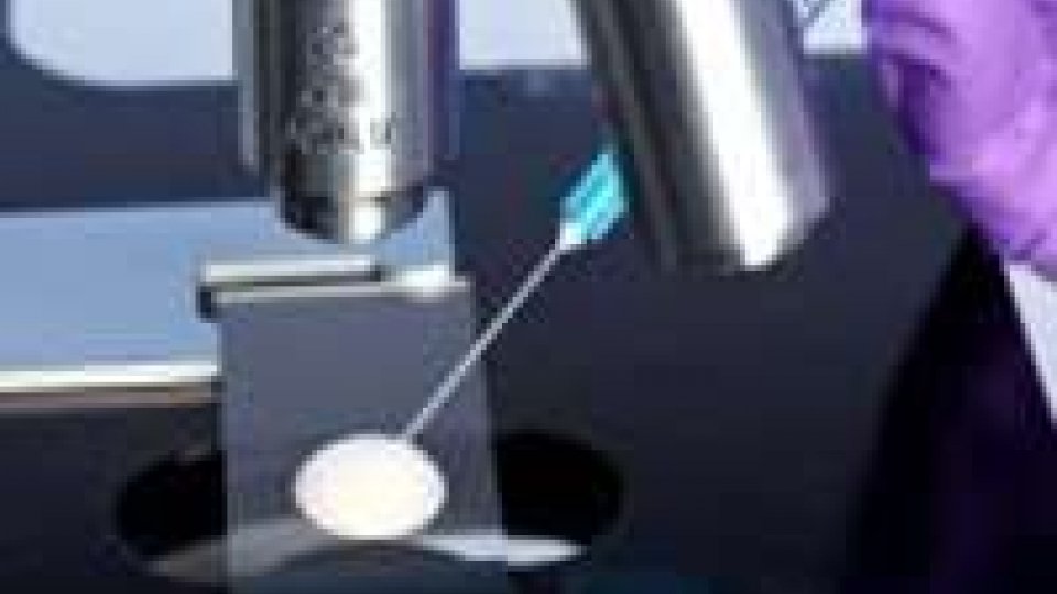 Microscopio-siringa vede cellule cancro sfuggite al chirurgo
