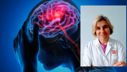 Emicrania: sintomi e cause del secondo mal di testa più diffuso. L'esperta spiega le nuove molecole efficaci per la cura